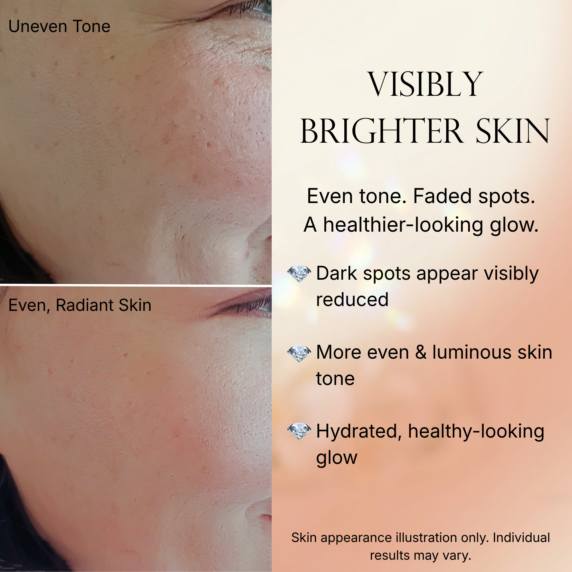 Even Tone Serum – Brightening Serum for Dark Spots & Hyperpigmentation with Kojic Acid, Hyaluronic Acid & Centella Asiatica – Radiant Healthy Glow – 1 fl oz / 30mL